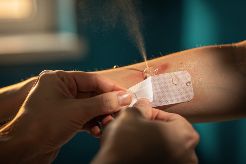 Enlever la colle de pansement sur la peau : 5 techniques douces